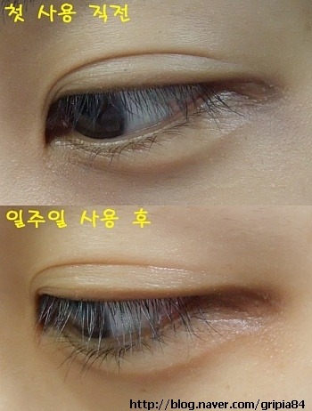 굿바이콤플렉스 이미지