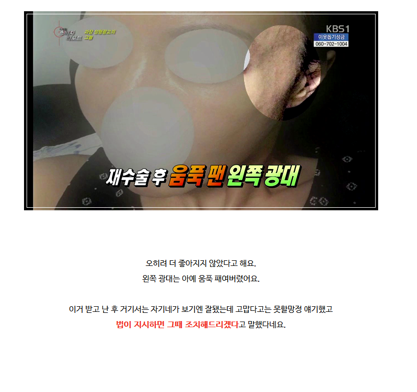 성형 과장광고 & 전후사진 모두 보정가짜 속지맙시다.jpg | 인스티즈