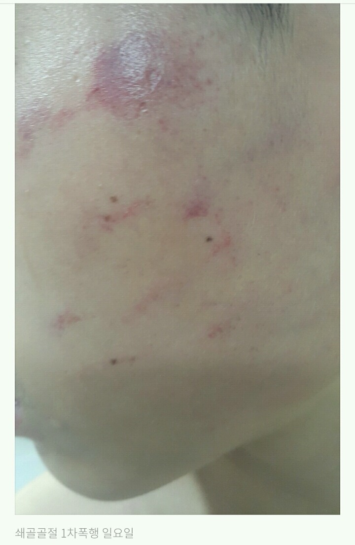 저희 아들이 집단 폭행을 당했습니다 jpg | 인스티즈