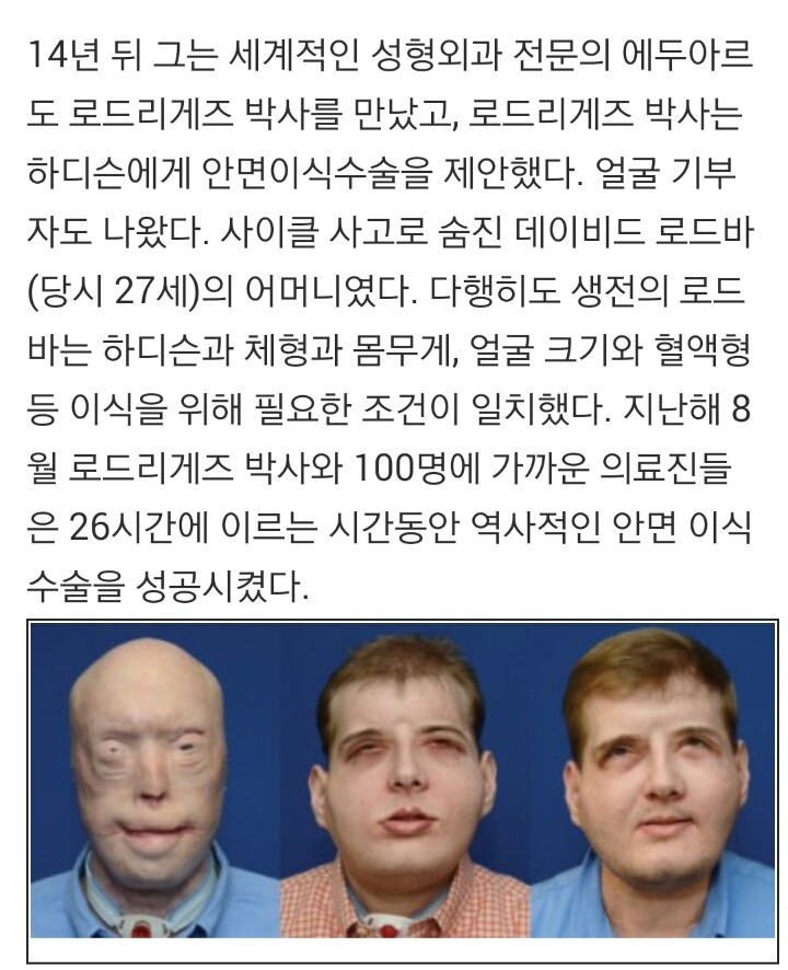 미국의 성형외과 수준 | 인스티즈