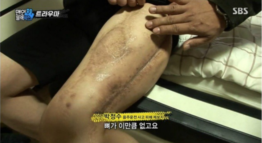 음주운전에 관대한 나라 | 인스티즈
