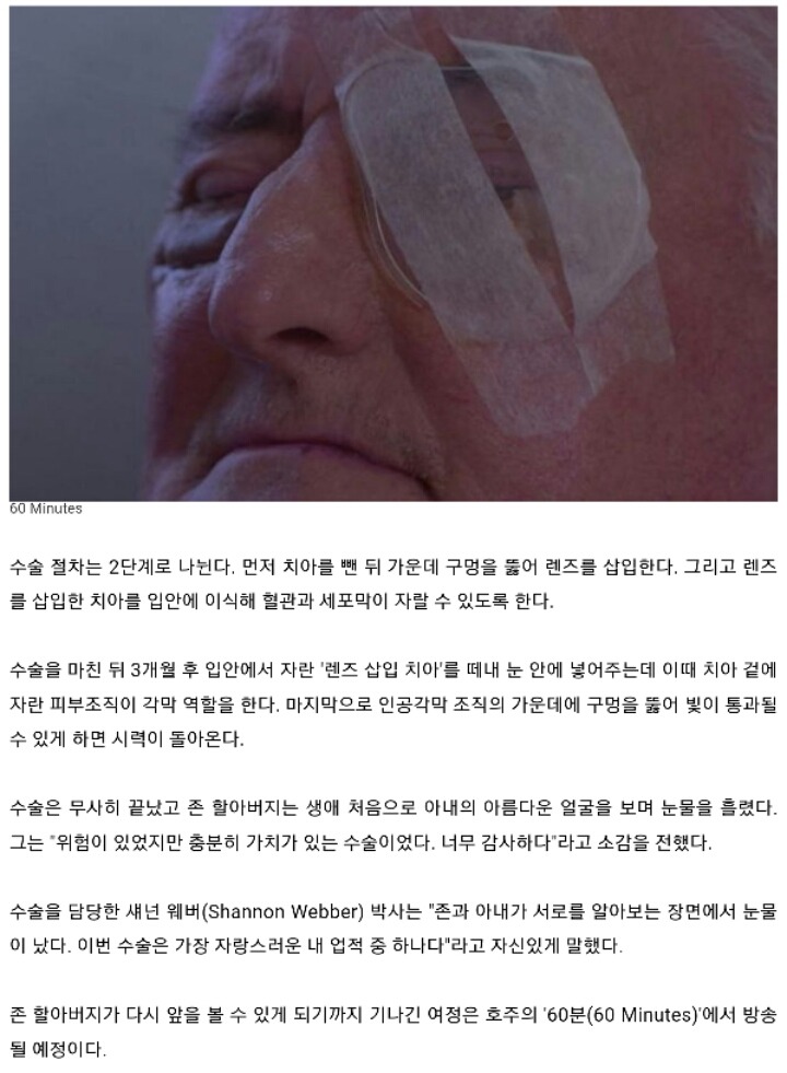 현대 의학의 위엄 | 인스티즈