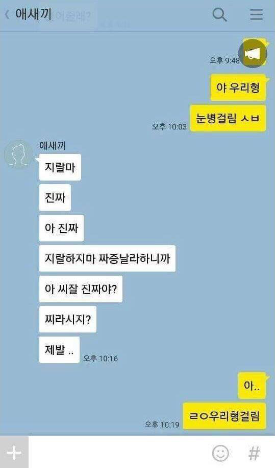 야 우리형 눈병걸림 | 인스티즈