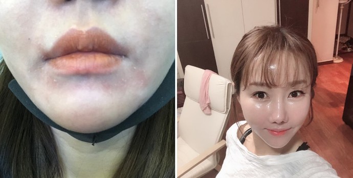 인셀덤 동안 이미지
