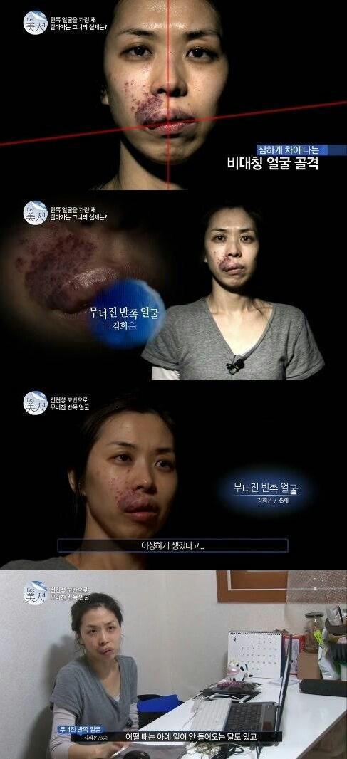 렛미인 이미지