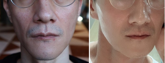 인셀덤 동안 이미지