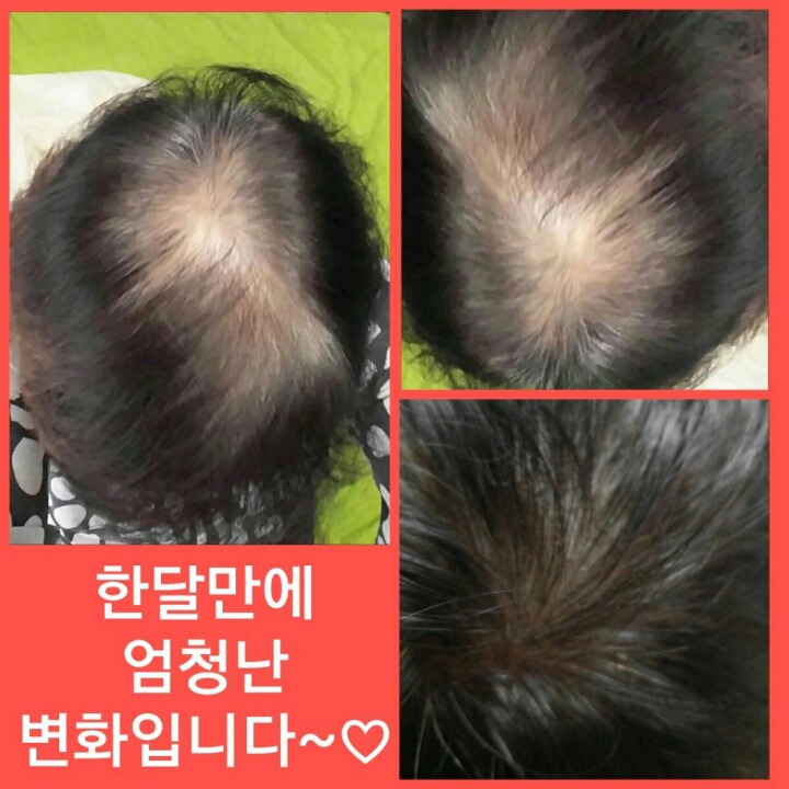 까망머리 이미지